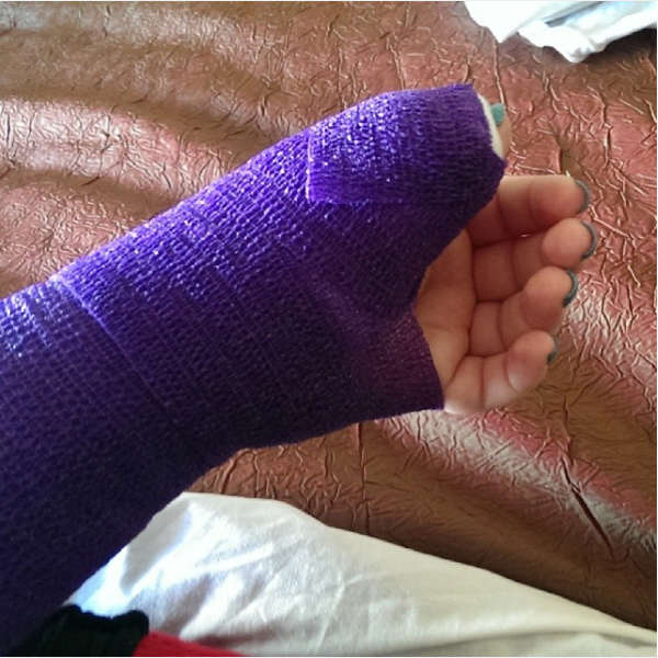 Skiier with broken wrist